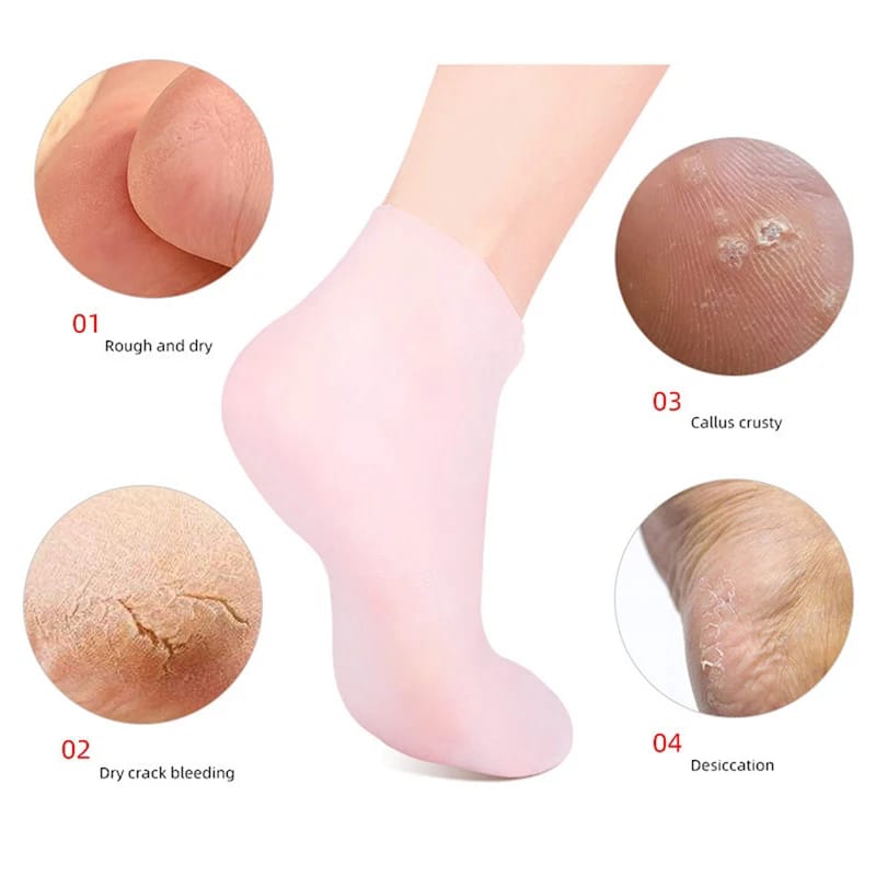 Moisturizing silicone socks